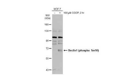 Western Blot: Beclin 1 [p Ser90] Antibody [NBP3-13298]